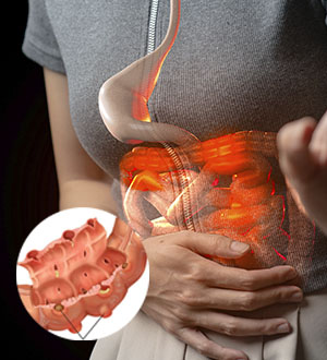 Diverticulite e Diverticulose  são a mesma coisa?