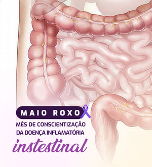 MAIO ROXO – MÊS DE CONSCIENTIZAÇÃO DA DOENÇA INFLAMATÓRIA INTESTINAL