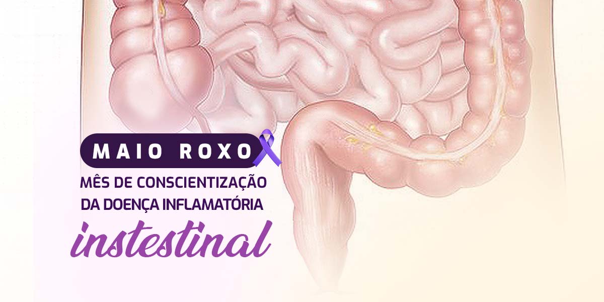 MAIO ROXO – MÊS DE CONSCIENTIZAÇÃO DA DOENÇA INFLAMATÓRIA INTESTINAL