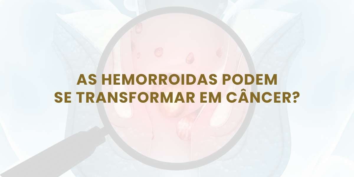 As Hemorroidas Podem ee Transformar em Câncer?