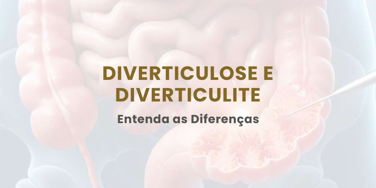 Diverticulose e Diverticulite: entenda as diferenças!