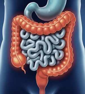 Doença de Crohn e Retocolite Ulcerativa: Muito Além do Intestino
