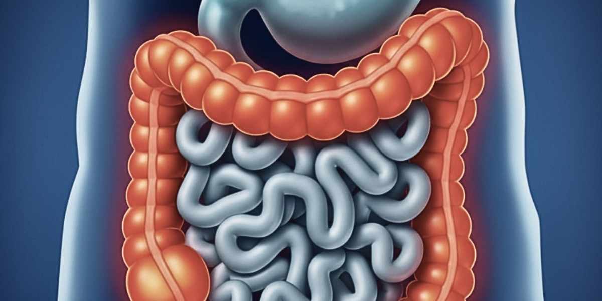 Doença de Crohn e Retocolite Ulcerativa: Muito Além do Intestino