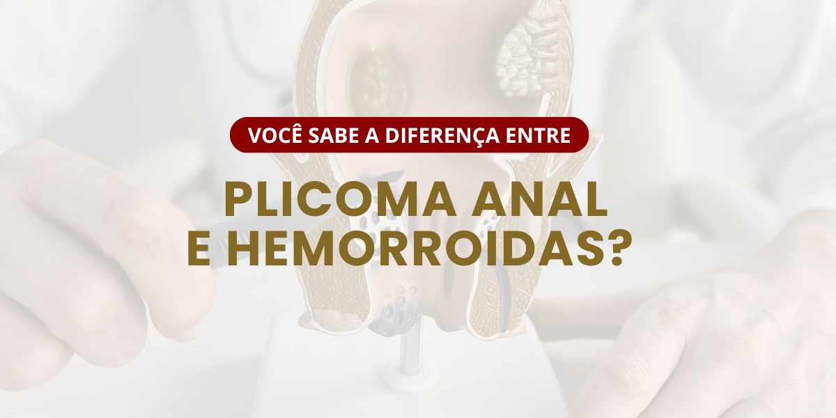 Plicoma Anal ou Hemorroida? Você sabe a diferença?