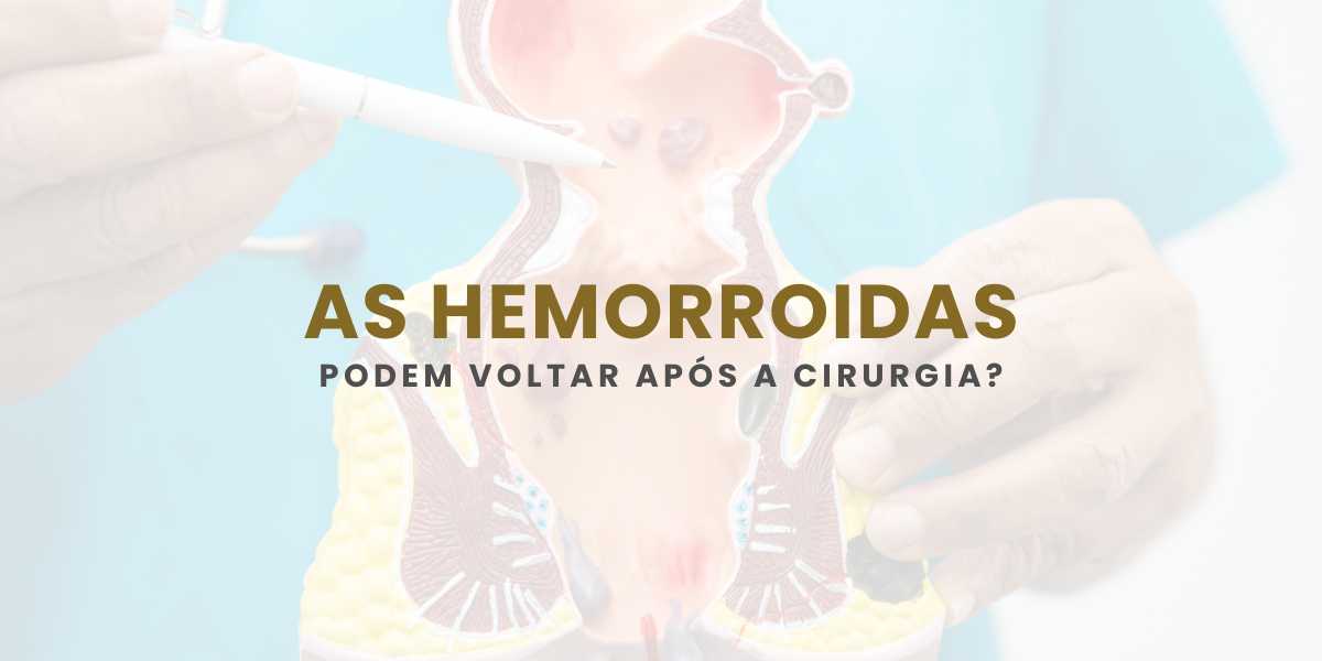 As hemorroidas podem voltar após a cirurgia? Entenda os riscos e como prevenir