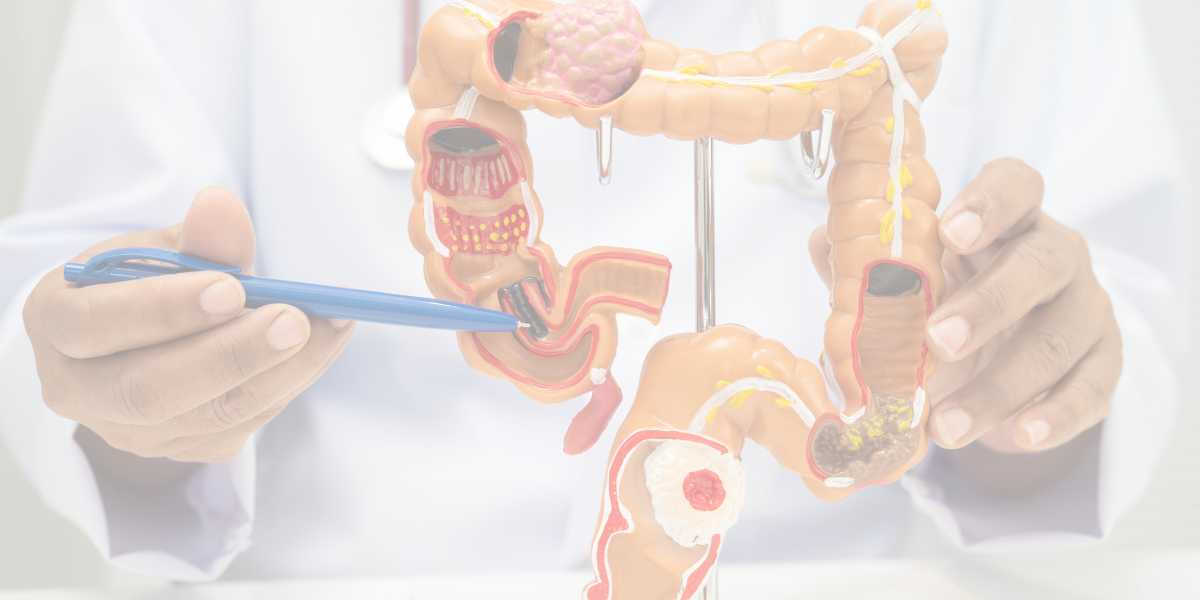 Câncer colorretal: como a cirurgia robótica pode transformar sua recuperação