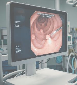 Colonoscopia sem medo: o que você precisa saber