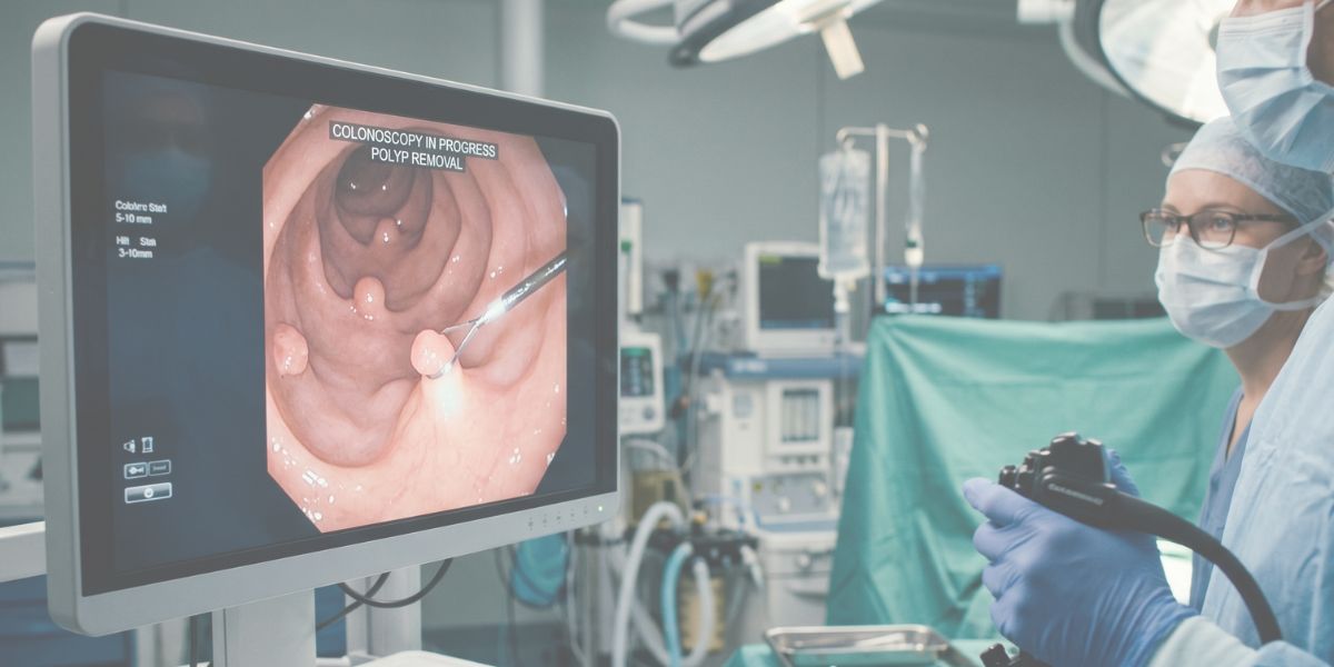 Colonoscopia sem medo: o que você precisa saber